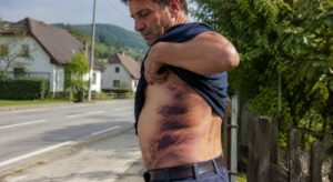 Grozljiv napad v Šmarjeških Toplicah: Dva mladoletnika, najverjetneje roma, naj bi s sekirama skoraj do smrti pretepla 38-letnika, njuna mati naj bi kričala: »Ubijta ga!« Slika je simbolična | FOTO: Pokukaj24.si / DALL·E